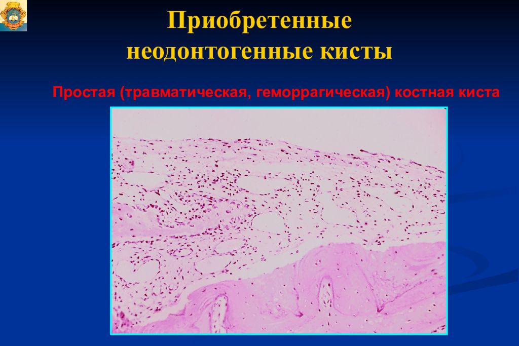 Опухоли опухолеподобные поражения и кисты кожи лица презентация