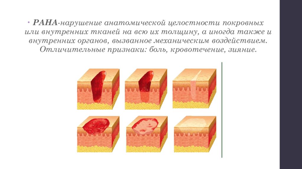 Какие рани есть. Нарушение анатомической целостности.