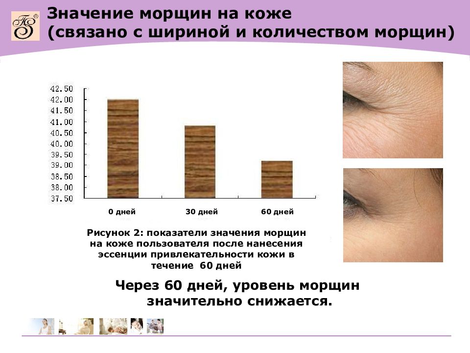 Количество кожи. Значение морщин. Значение складок кожи. Морщинки значение. Сколько занимает полная смена кожи лица.