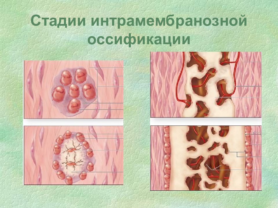 Пороки развития опорно двигательного аппарата презентация