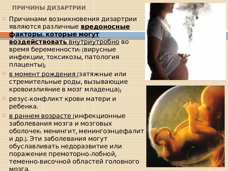 Дизартрия возникает. Причины возникновения дизартрии. Причины возникновения ДИЗАРТ. Факторы появления дизартрии. Причины дизартрии у детей и взрослых.