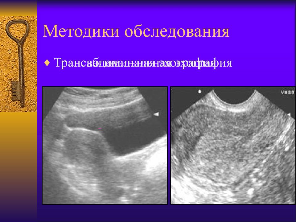 Методы обследования в акушерстве презентация