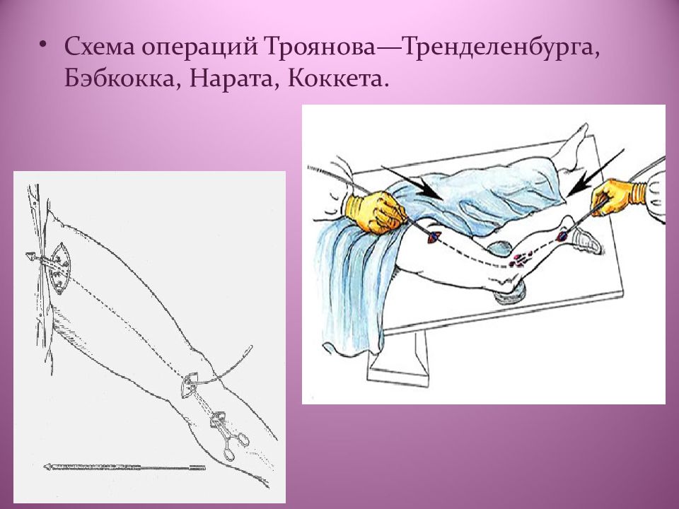 Операция троянова