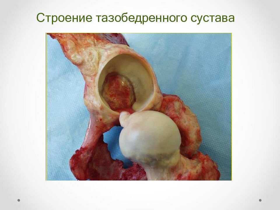 Строение тазобедренного сустава