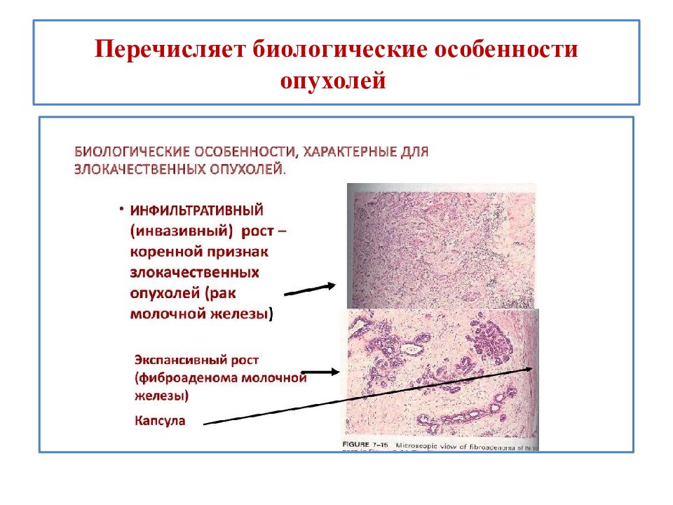 Перечислите биологические. Биологические особенности опухолей. Биологические особенности опухолевого роста. Биологические особенности опухолевых клеток. Назовите биологические особенности опухоли.