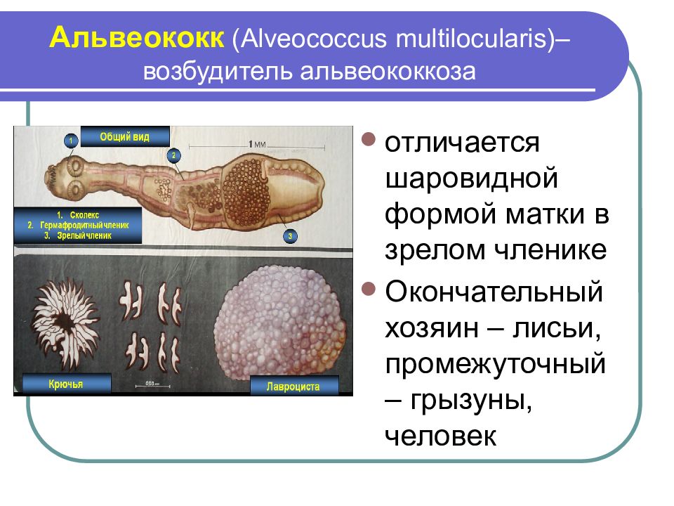 Клиническая картина альвеококкоза