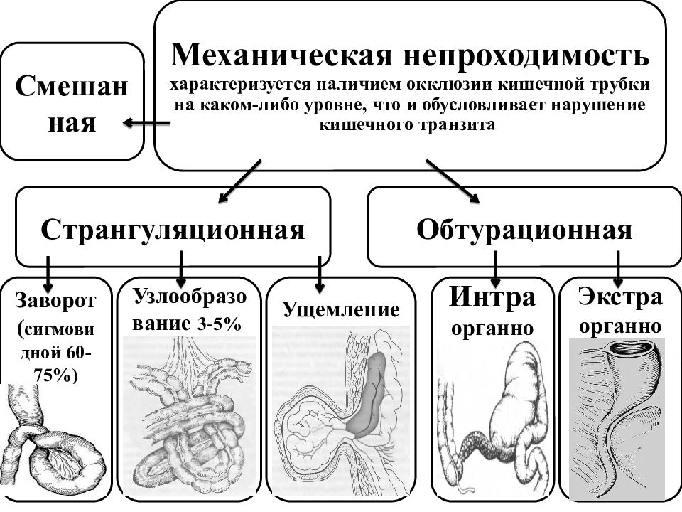 Клиническая картина острой кишечной непроходимости