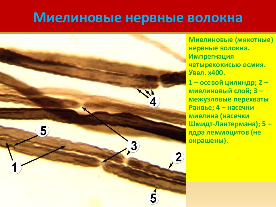 Рисунок миелиновые нервные волокна