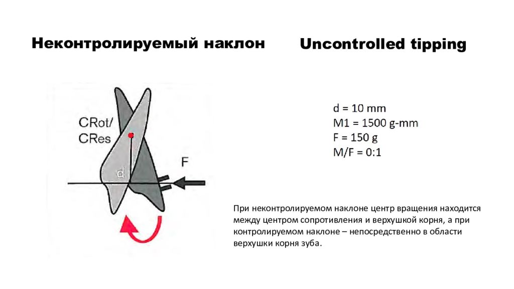 Биомеханика в ортодонтии презентация