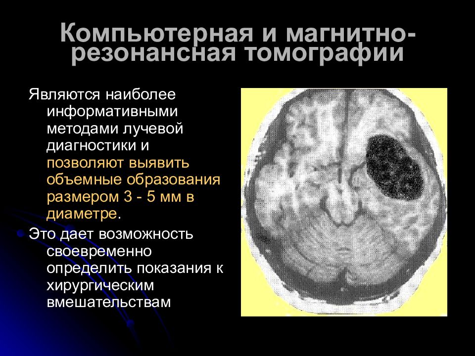 Диагностика опухолей головного мозга презентация