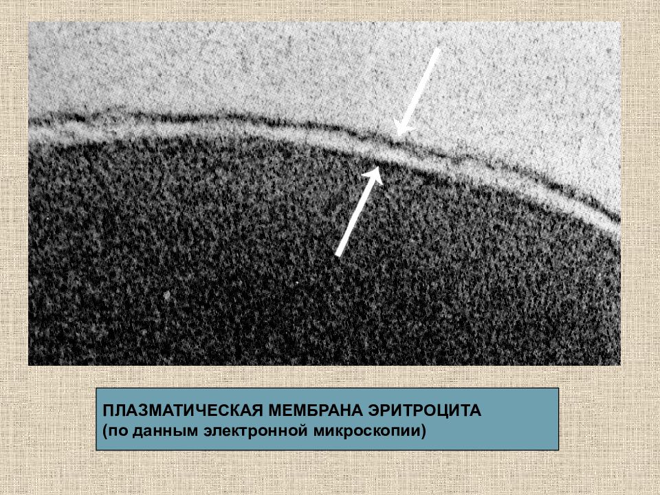 Рассмотрите световую микрофотографию. Плазматическая мембрана микроскоп. Микрофотография плазматической мембраны. Мембрана эритроцитов под микроскопом. Мембрана электронная микроскопия.