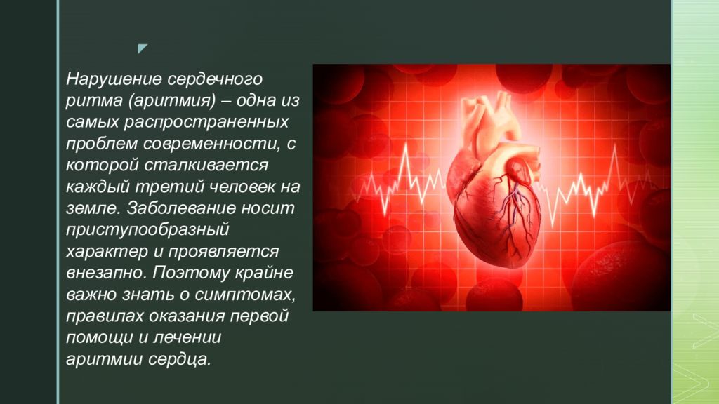 Нарушение сердечного. Сообщение о заболевании сердца аритмия. Аритмия в композиции. Аритмия латынь. Аритмия сердца в алкогольном опьянении.