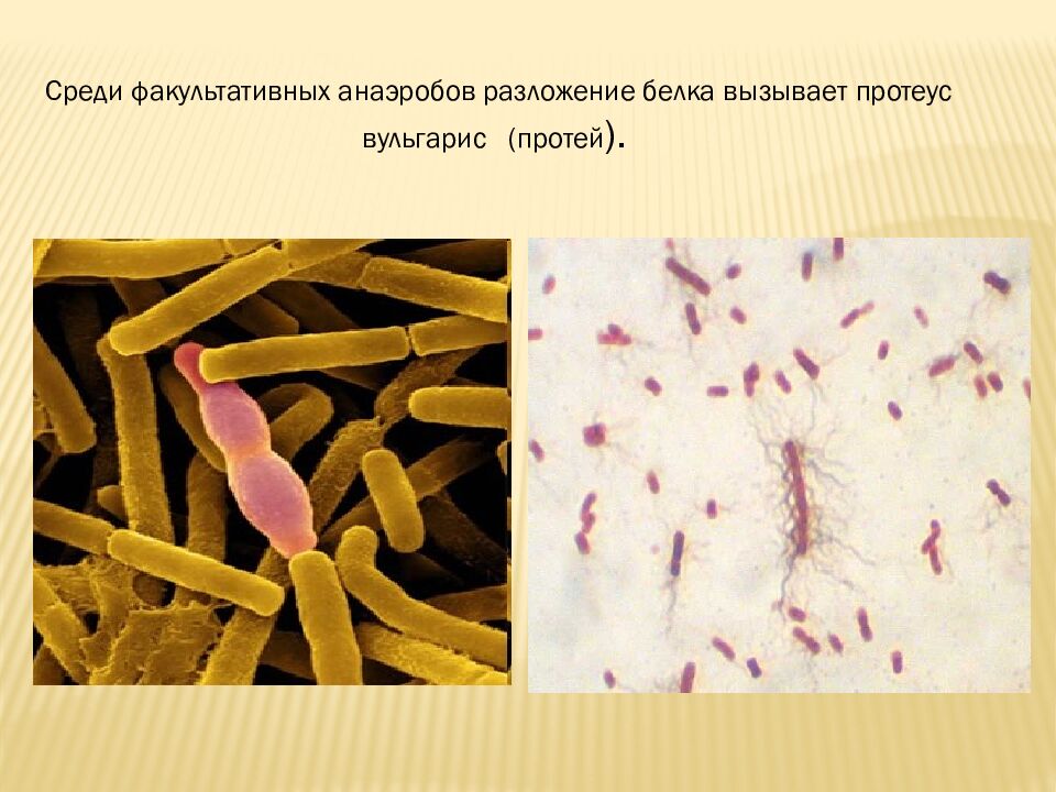 презентация: Тема: «ВИДЫ БАКТЕРИЙ»