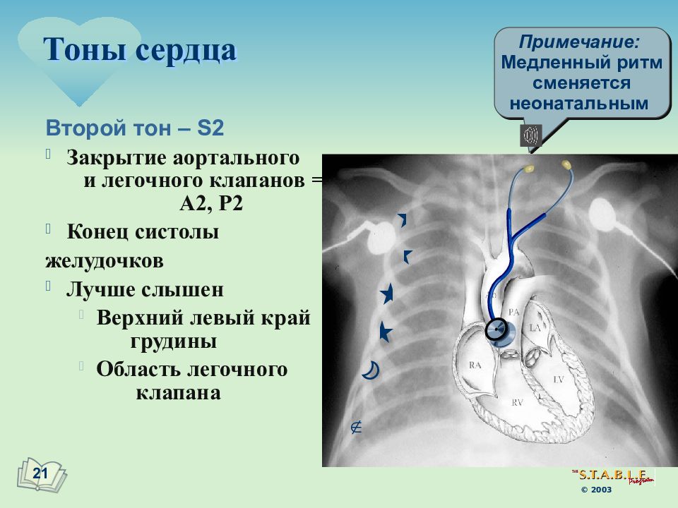 Тоны сердца. Ритмичность тонов сердца. 2 Тон сердца. Медленный ритм сердца. Тоны и клапаны сердца.