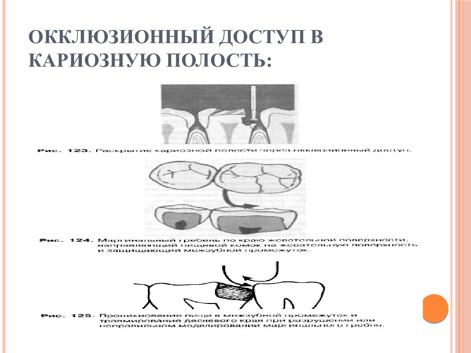 Дном кариозной полости принято считать стенку