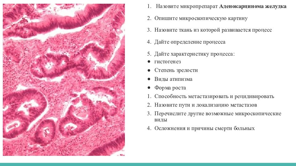 Рак желудка патанатомия презентация