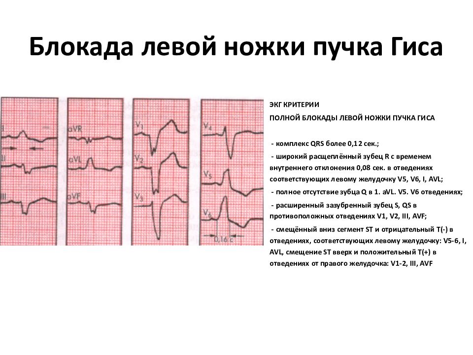 Презентация пропедевтика экг