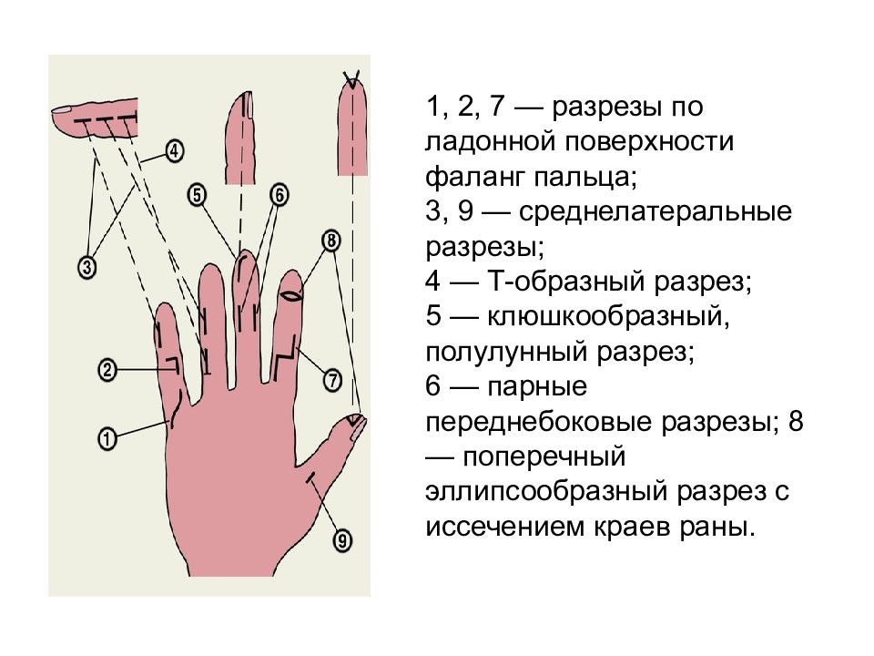 Фаланги пальцев рук. Первая фаланга среднего пальца правой руки. Концевая фаланга большого пальца руки. Фаланга указательного пальца.