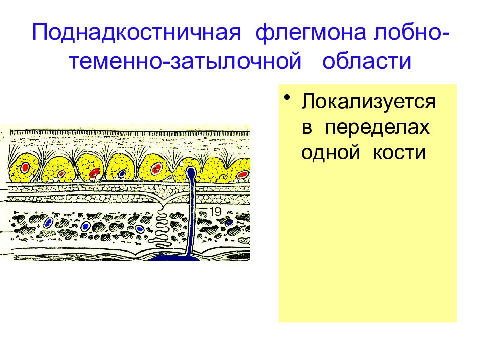 Лобно теменно затылочная область. Поднадкостничная флегмона. Поднадкостничная гематома лобно-теменно-затылочной области. Лобно теменно затылочная повязка. Лобно-теменно-затылочная область гнойники.