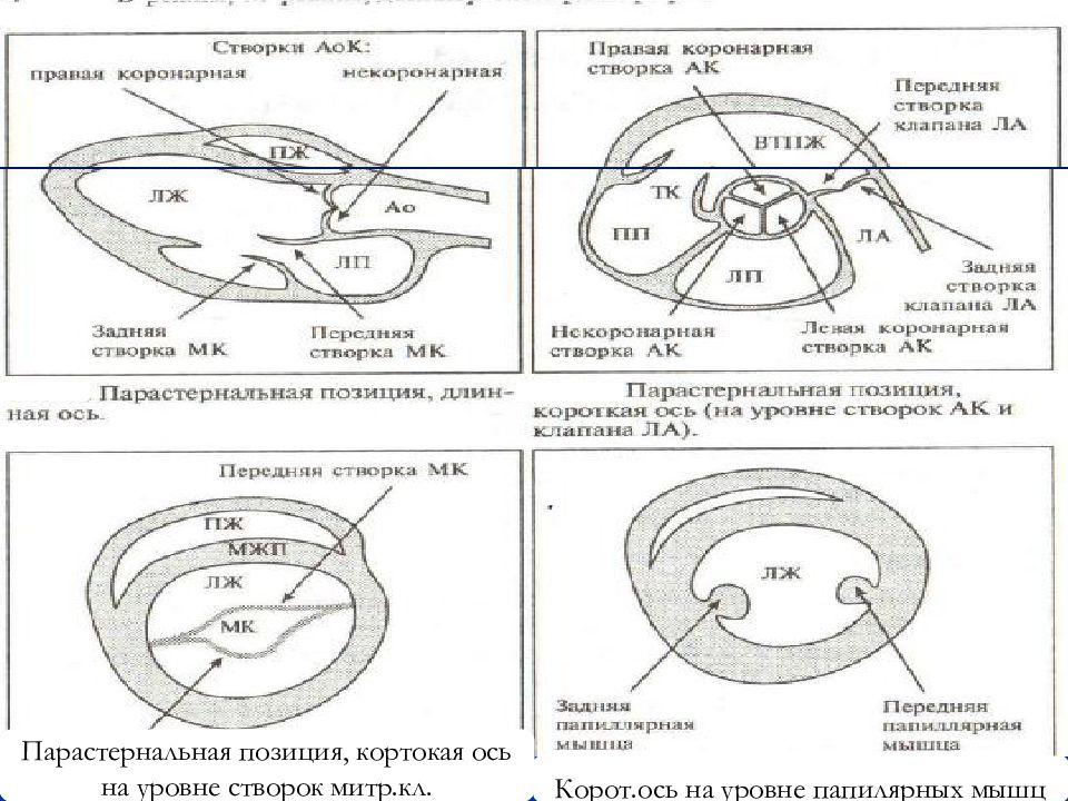 Узи сердца схема