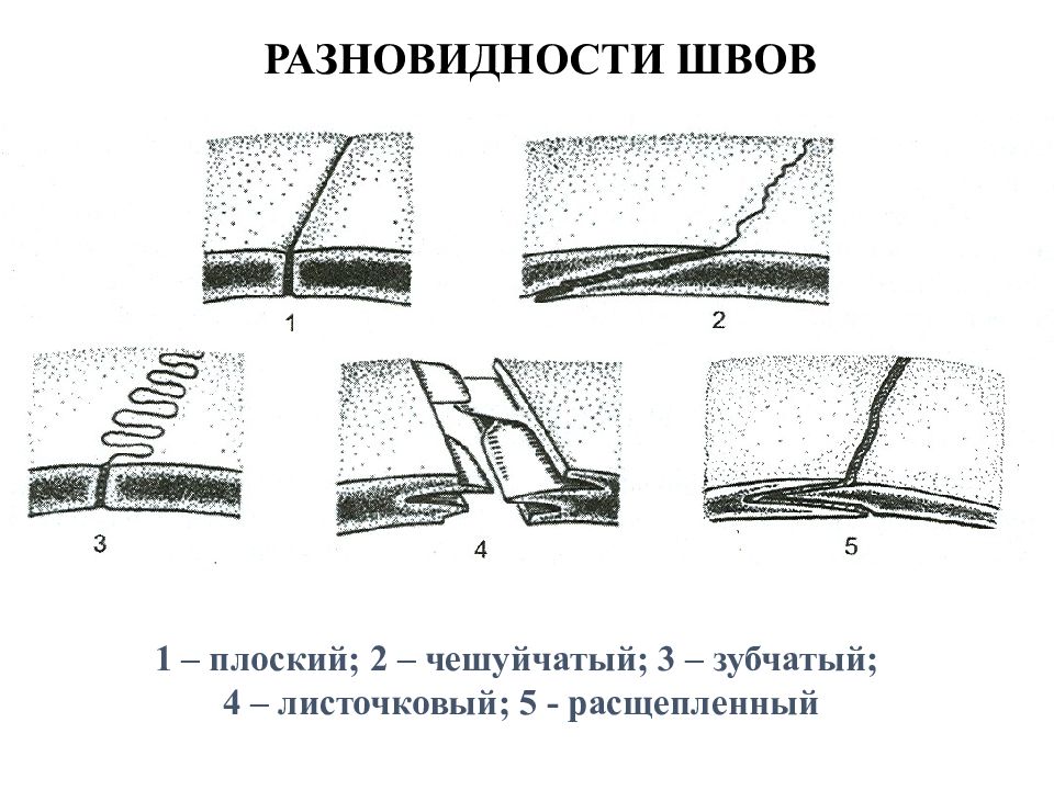 Что значит плоский. Чешуйчатый шов зубчатый шов анатомия. Плоский шов соединения костей. Швы зубчатые чешуйчатые плоские. Схема швов на местах соединения плоских костей.