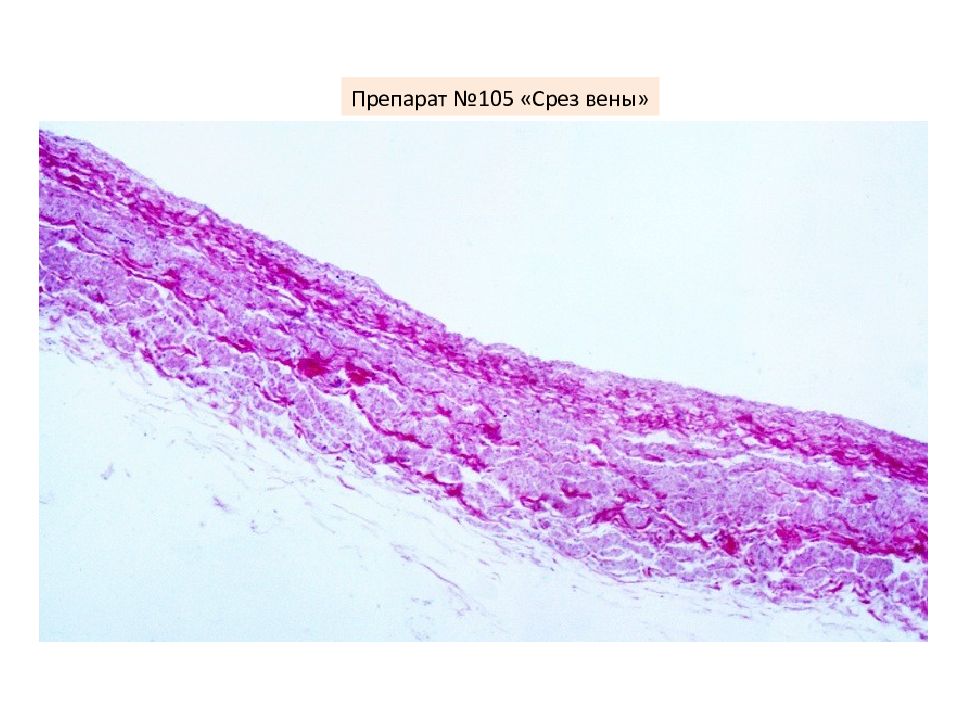 Вена препарат. Гистология сосудистой стенки. Нижняя полая Вена гистология препарат. Стенка вены гистология. Нижняя полая Вена гистология.