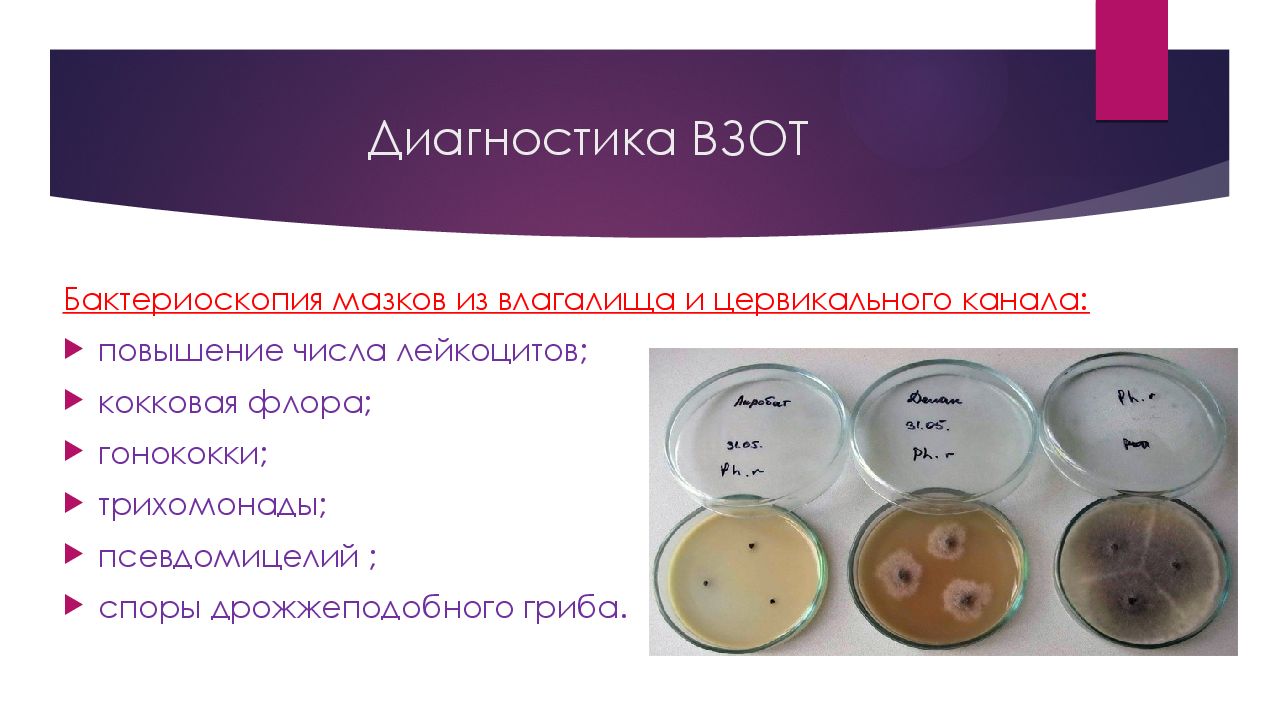 Цервикальный это. Бактериоскопия мазка. Мазок из цервикального канала и влагалища. Бактериоскопия шейки матки.