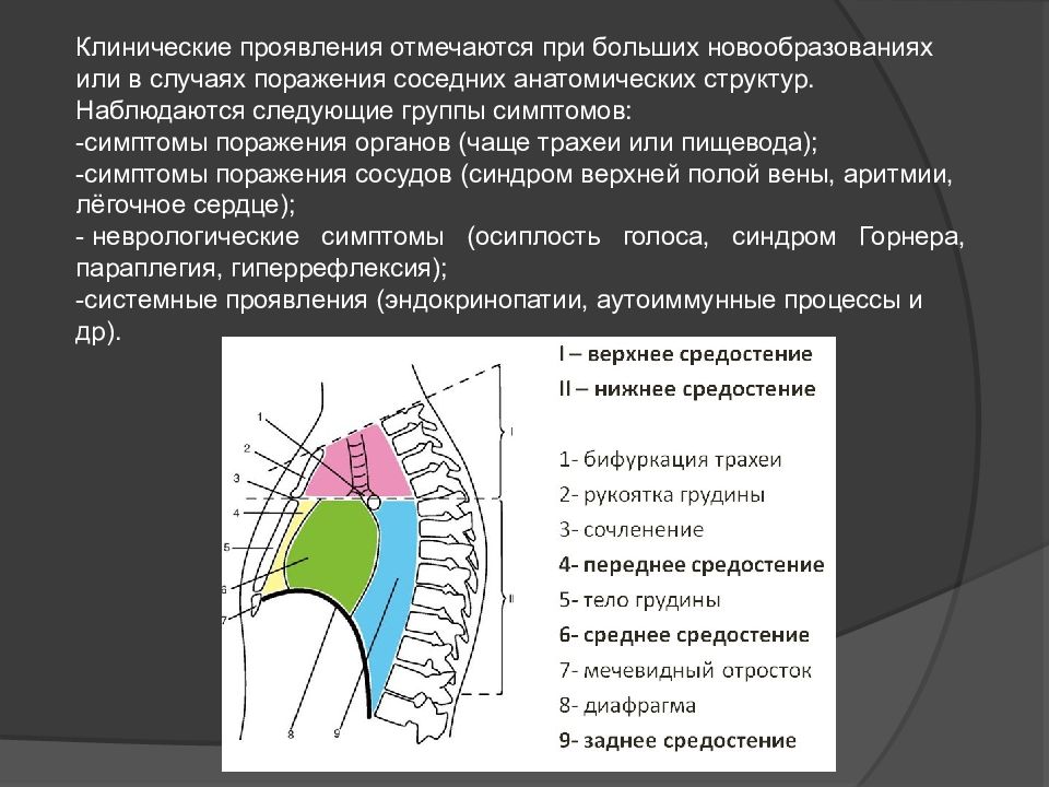 Образования средостения схема