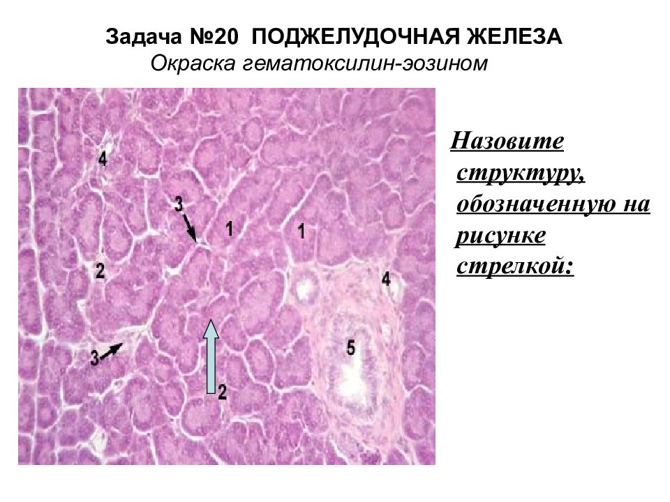 Железы задания. Окраска гематоксилином и эозином методика. Гематоксилин окрашивает структуры. Печень человека окраска гематоксилин-эозином. Тонкая кишка и поджел железа препарат.