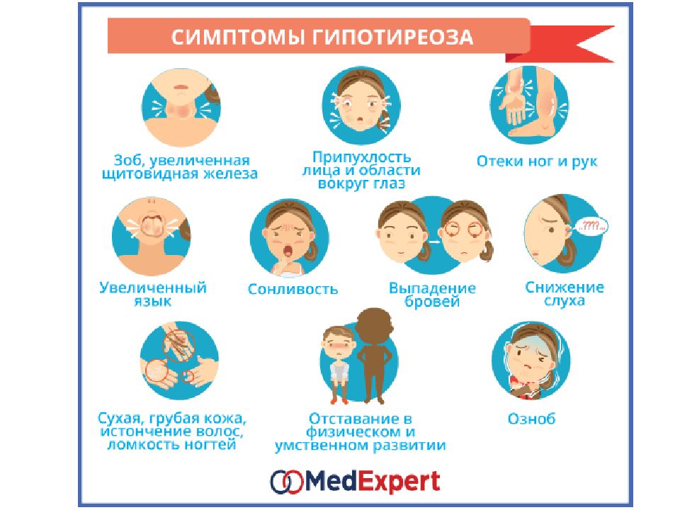 Гипотиреоз щитовидной. Основные симптомы гипотиреоза. Симптомы гипотериозаз.