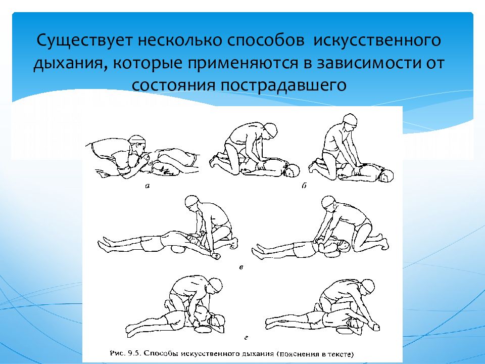 Способы искусственного дыхания. Освоение основных способов искусственного дыхания. Способы проведения искусственного дыхания. Основные приемы проведения искусственного дыхания.