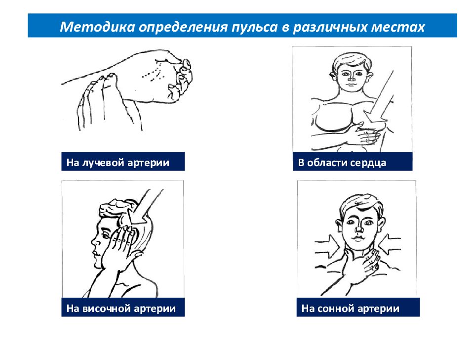 Методика определения пульса на лучевой артерии. Измерение пульса на височной артерии. Измерение пульса алгоритм. Пульс на височной артерии.