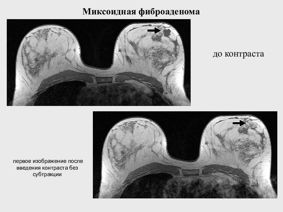 После изображение