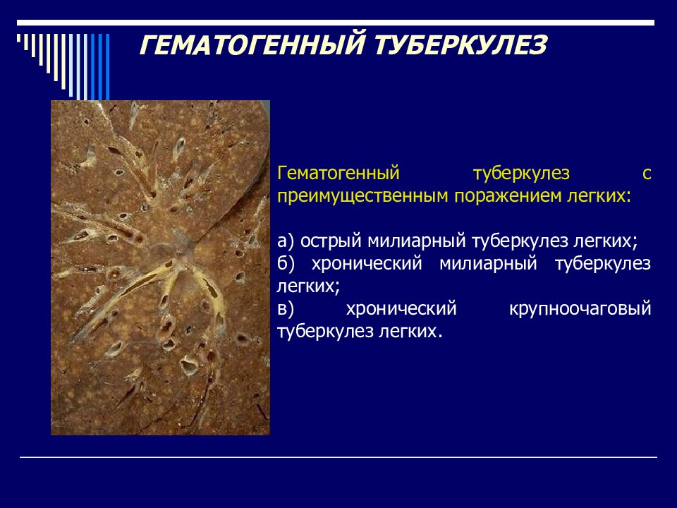 Опишите рисунок пораженного туберкулезом легкого