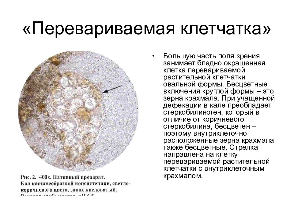 Копрограмма в картинках