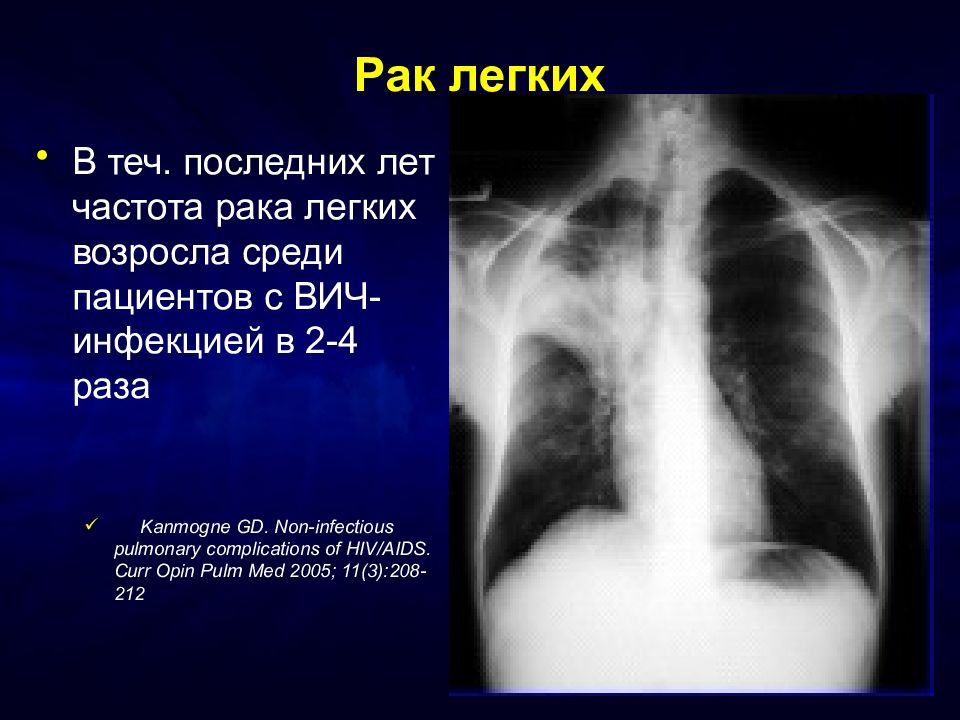 Возраст легких. Возраст лёгких 25 гг.