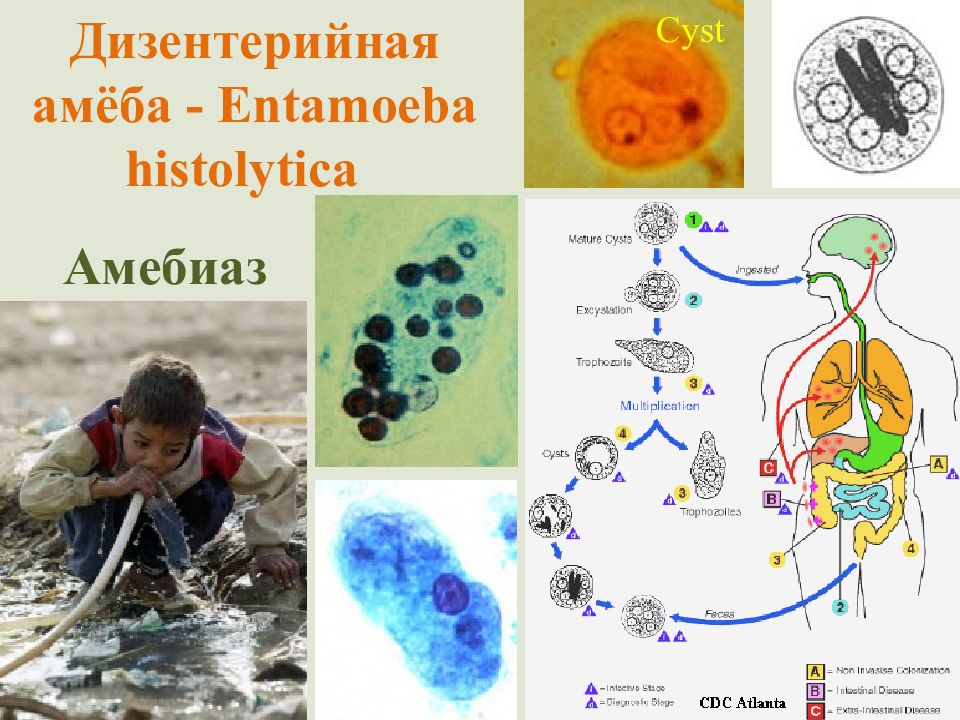 Презентация амебиаз микробиология