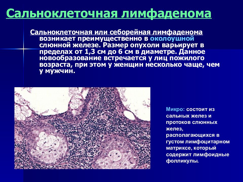 Лучевая терапия при раке слюнных желез