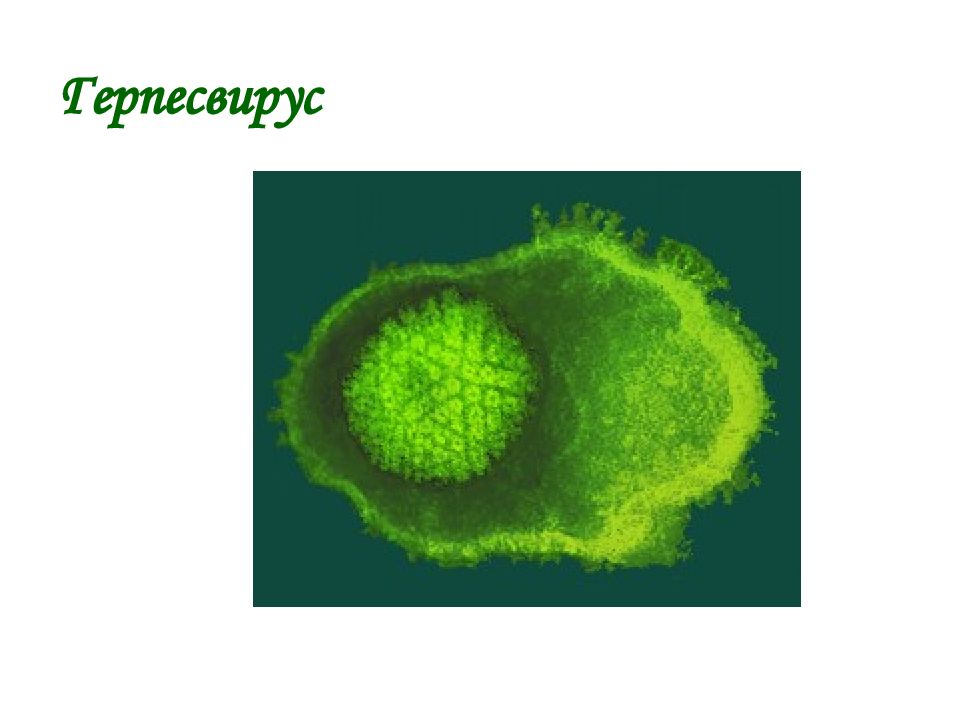 Герпес микробиология презентация