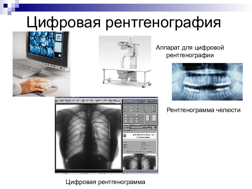 Рентгенография в стоматологии презентация