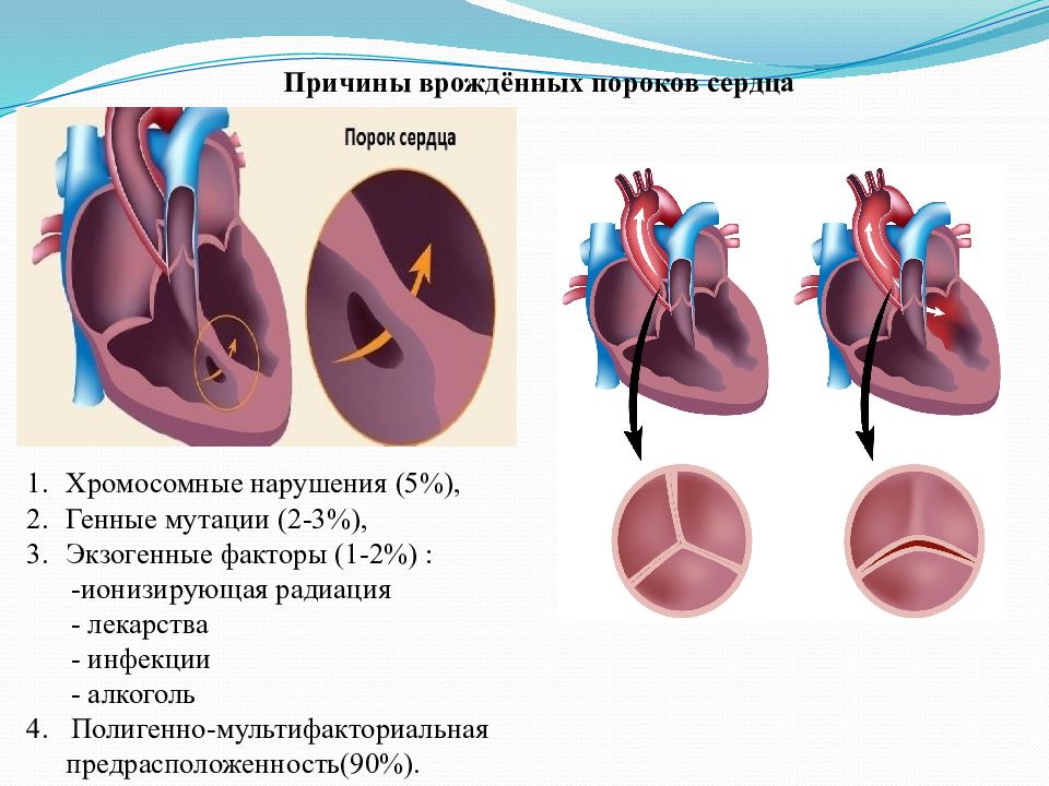 Порок сердца картинки сердца