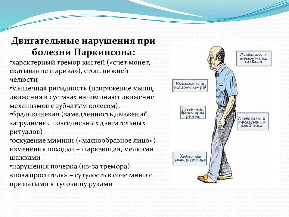 Упражнения при паркинсонизме в картинках