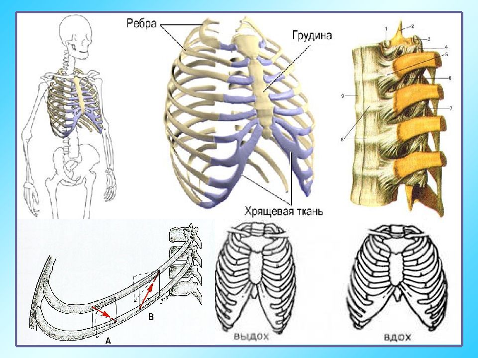 Старение дыхательной системы. Перелом ребра строение ребер. Грудная клетка реберные хрящи. Анатомия грудной клетки ребенка.