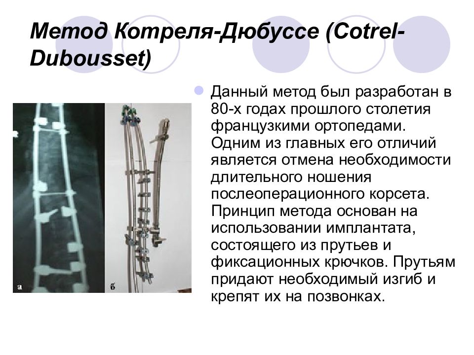 Хирургическое лечение сколиоза презентация