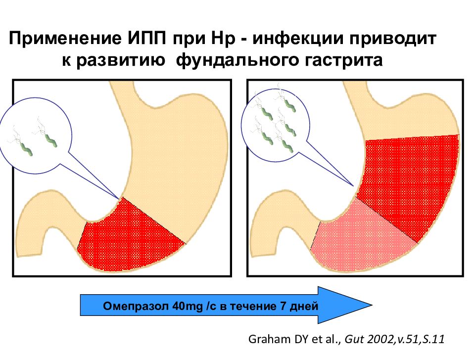 Что такое ингибиторы протонной помпы. Ингибиторы протонной помпы. Ингибиторы протонной помпы препараты. Ингибиторы протонной помпы при язвенной болезни. Ингибиторы протонной помпы препараты список.