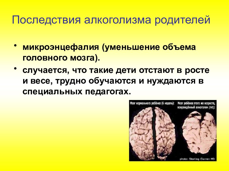 Врожденные заболевания презентация 8 класс