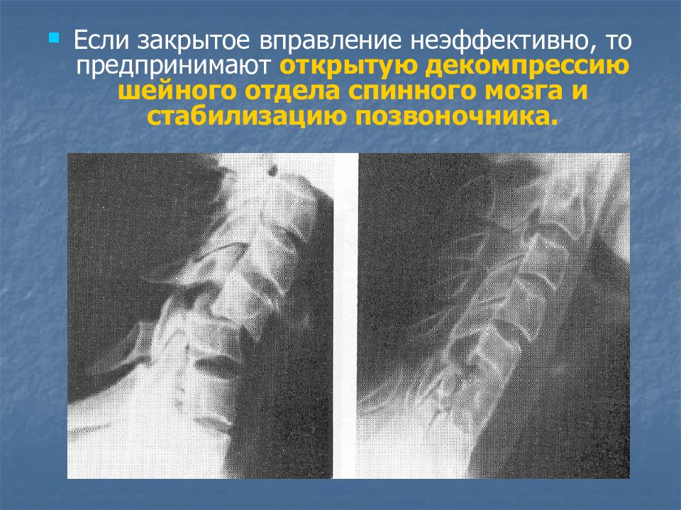 Повреждения шейного отдела позвоночника презентация