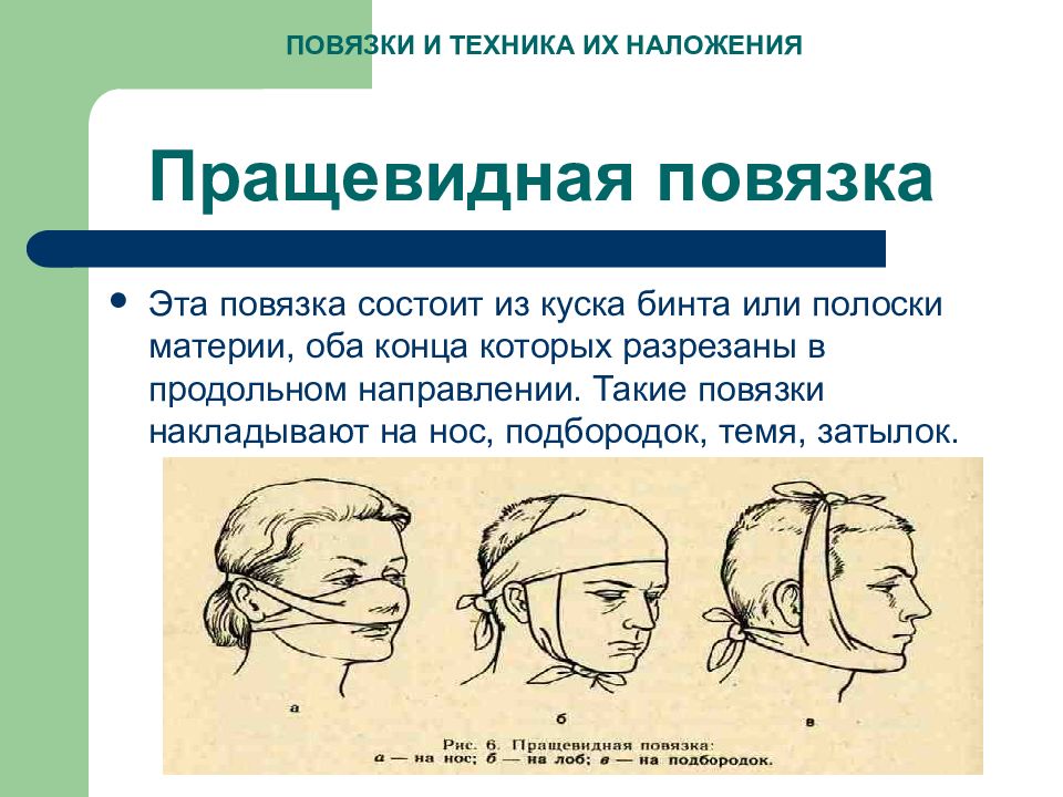 Повязки и техника их наложения — презентация