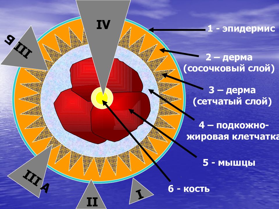 Презентация по хирургии ожоги