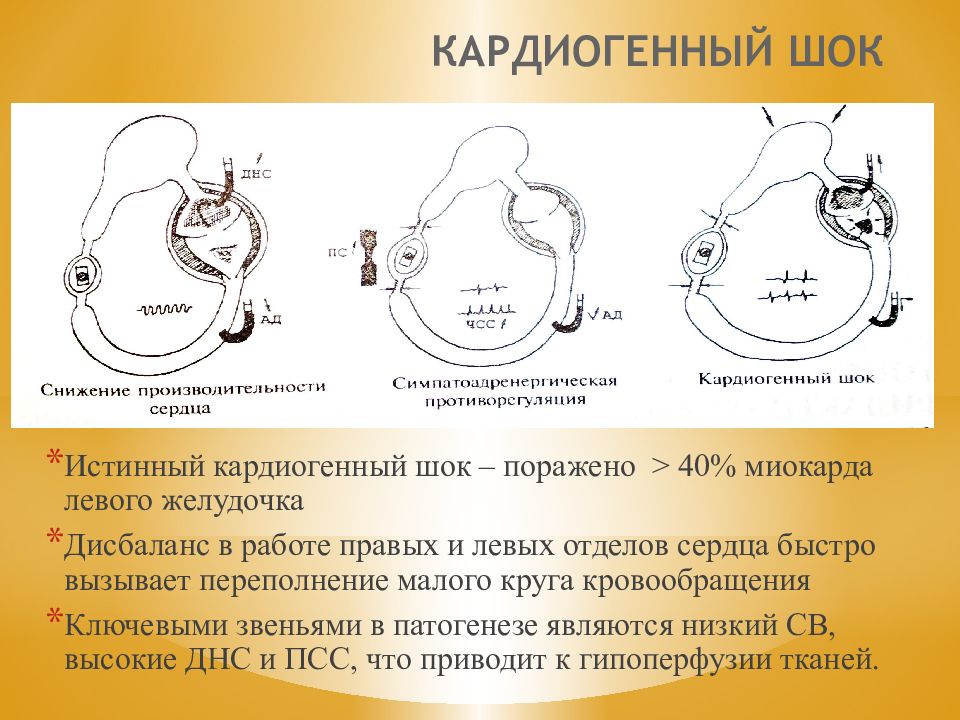 Презентация на тему кардиогенный шок